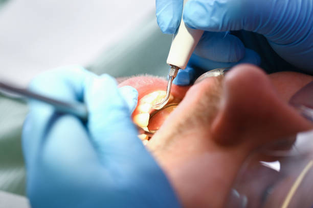 Best Weekend Emergency Dental Services in Wahese, NC